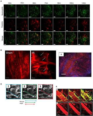 Live Intravital Imaging of Cellular Trafficking in the Cardiac Microvasculature—Beating the Odds